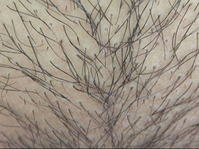 300人のまん毛3　サンプル画像09